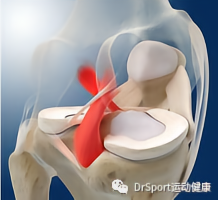 澳门人威尼斯官网运动科普：你真的了解膝关节吗？(图5)