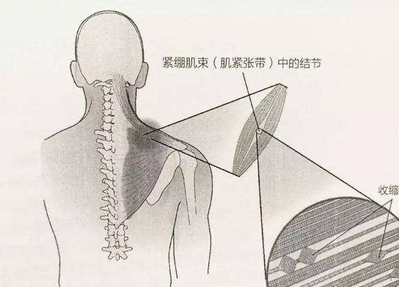 澳门人威尼斯官网「筋膜放松动作大合集」缓解紧张肌肉增强运动表现(图2)